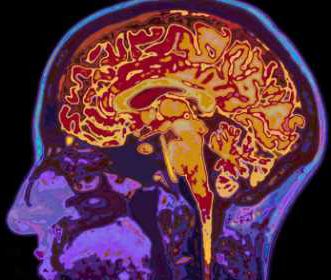 动物实验：您的大脑可能比您的身体还老