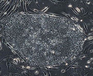 皮肤干细胞培育出人类“迷你”心脏，未来将可替代动物实验