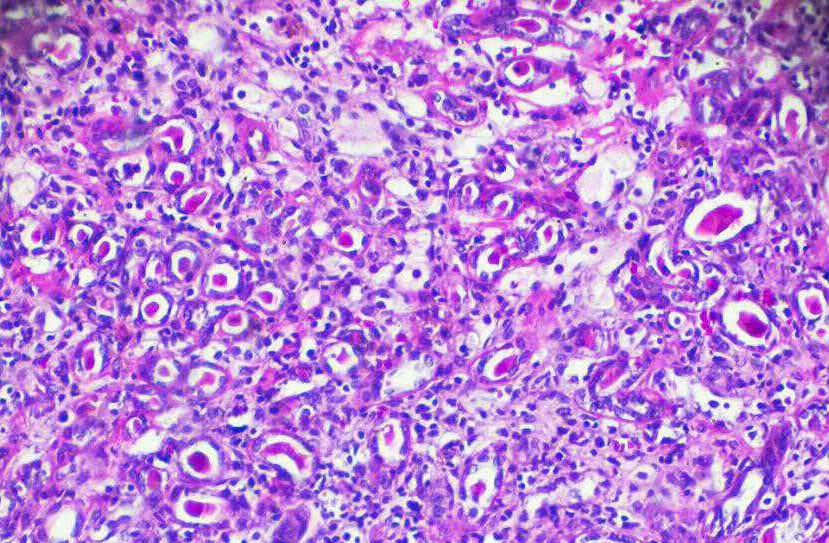 【动物造模】-科学家鉴定出能刺激小鼠肌肉细胞的化合物