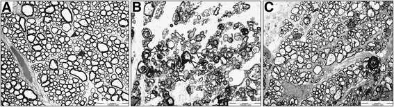 【动物造模】-视网膜缺血大鼠模型