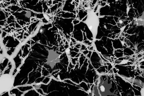 动物造模技术揭示神秘萎缩脑细胞或同阿尔茨海默氏症相关