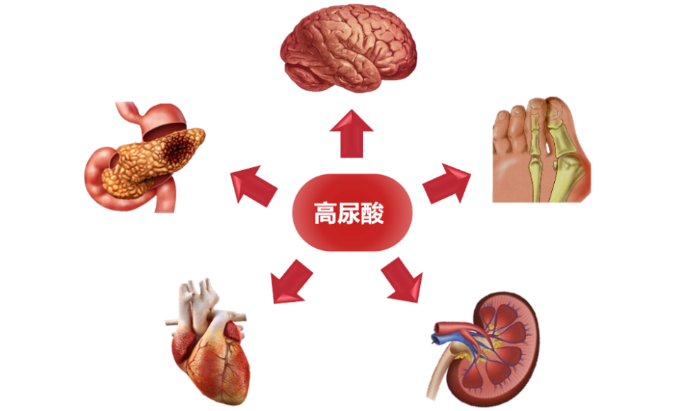 【Animal Modeling】-Establishment and Research of Rat Hyperuricemia Model