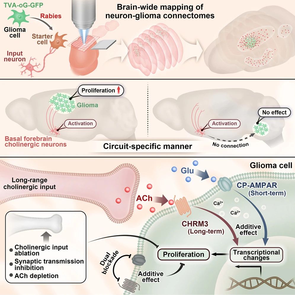 Cancer Cell|卞修武院士团队破解脑瘤“遥控”新机制